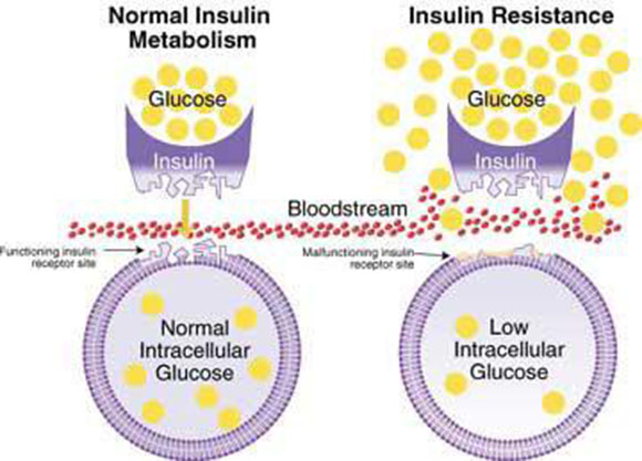 Insulinresistance